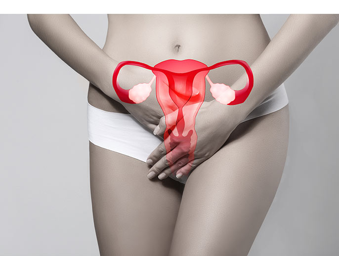rak jajnika objawy rak jajników jak leczyć leczenie raka jajnika