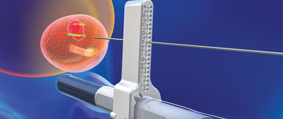 biopsja fuzyjna prostaty w krakowskim szpitalu na klinach